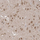 Anti-GSK3B Antibody