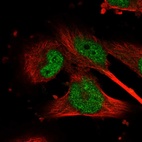 Immunofluorescent staining of human cell line U-251 MG shows localization to nucleoplasm.