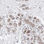Anti-ODF2L Antibody