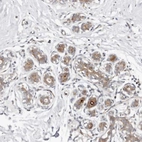 Anti-ODF2L Antibody
