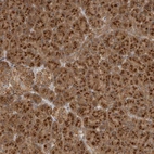 Immunohistochemical staining of human pancreas shows moderate to strong granular cytoplasmic positivity in exocrine glandular cells.