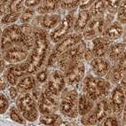 Immunohistochemical staining of human stomach shows moderate granular cytoplasmic positivity in glandular cells.