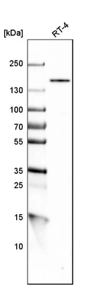 Western blot analysis in human cell line RT-4.