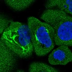 Immunofluorescent staining of human cell line A-431 shows positivity in cytoplasm, intermediate filaments & nucleus but excluded from the nucleoli.