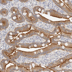 Immunohistochemical staining of human Duodenum shows moderate cytoplasmic and membranous positivity in glandular cells.