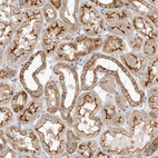 Anti-USH1C Antibody