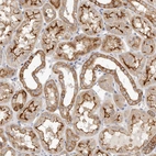 Immunohistochemical staining of human Kidney shows moderate cytoplasmic and membranous positivity in cells in tubules.