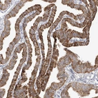 Immunohistochemical staining of human Fallopian tube shows moderate cytoplasmic and membranous positivity in glandular cells.