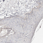 Immunohistochemical staining of human Skin shows no positivity in squamous epithelial cells as expected.