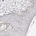 Anti-USH1C Antibody