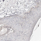 Immunohistochemical staining of human Skin shows no positivity in squamous epithelial cells as expected.