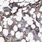Anti-SPTA1 Antibody