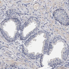 Immunohistochemical staining of human prostate shows no positivity in glandular cells as expected.