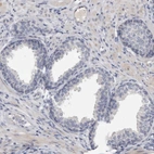 Immunohistochemical staining of human prostate shows no positivity in glandular cells as expected.