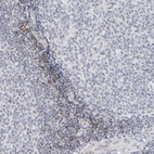 Anti-METTL11B Antibody