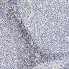 Immunohistochemical staining of human tonsil shows weak to moderate nuclear positivity in non - germinal center cells.
