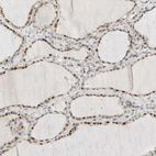 Immunohistochemical staining of human thyroid gland shows moderate to strong nuclear positivity in glandular cells.