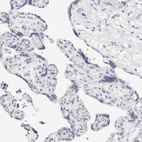 Immunohistochemical staining of human placenta shows no positivity in trophoblastic cells as expected.