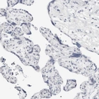 Immunohistochemical staining of human placenta shows no positivity in trophoblastic cells as expected.