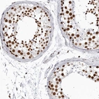 Immunohistochemical staining of human testis shows strong nuclear positivity in cells in seminiferous ducts.