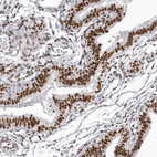 Immunohistochemical staining of human fallopian tube shows strong nuclear positivity in glandular cells.
