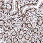 Immunohistochemical staining of human small intestine shows strong nuclear positivity in glandular cells.