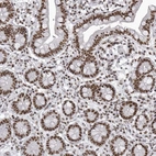 Immunohistochemical staining of human small intestine shows strong nuclear positivity in glandular cells.