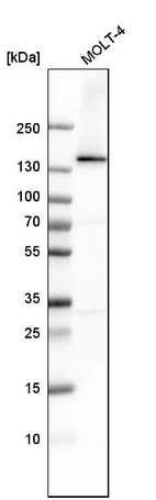 Western blot analysis in human cell line MOLT-4.