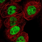 Immunofluorescent staining of human cell line A-431 shows localization to nucleoplasm.