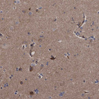 Immunohistochemical staining of human cerebral cortex shows moderate cytoplasmic positivity in neurons.