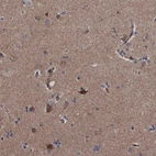 Immunohistochemical staining of human cerebral cortex shows moderate cytoplasmic positivity in neurons.