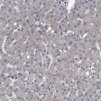 Immunohistochemical staining of human liver shows negative positivity in hepatocytes as expected.