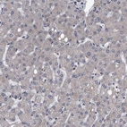 Immunohistochemical staining of human liver shows negative positivity in hepatocytes as expected.