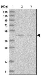 Lane 1: Marker [kDa] 230, 130, 95, 72, 56, 36, 28, 17, 11_br/_Lane 2: Human cell line RT-4_br/_Lane 3: Human cell line U-251MG sp