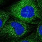 Immunofluorescent staining of human cell line A-431 shows localization to microtubules.