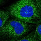 Immunofluorescent staining of human cell line A-431 shows localization to microtubules.