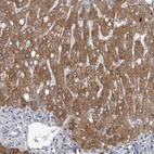 Anti-LYSMD1 Antibody