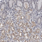 Immunohistochemical staining of human stomach shows weak cytoplasmic positivity in glandular cells.
