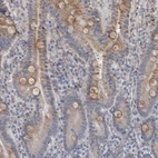 Immunohistochemical staining of human upper dodenum shows weak cytoplasmic positivity in glandular cells.