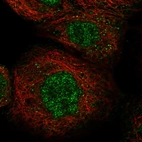 Immunofluorescent staining of human cell line A-431 shows localization to nucleoplasm.