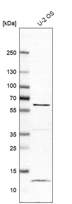 Anti-LRRC6 Antibody