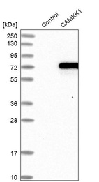 Anti-CAMKK1 Antibody