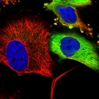 Immunofluorescent staining of human cell line U-251 MG shows localization to cytosol.
