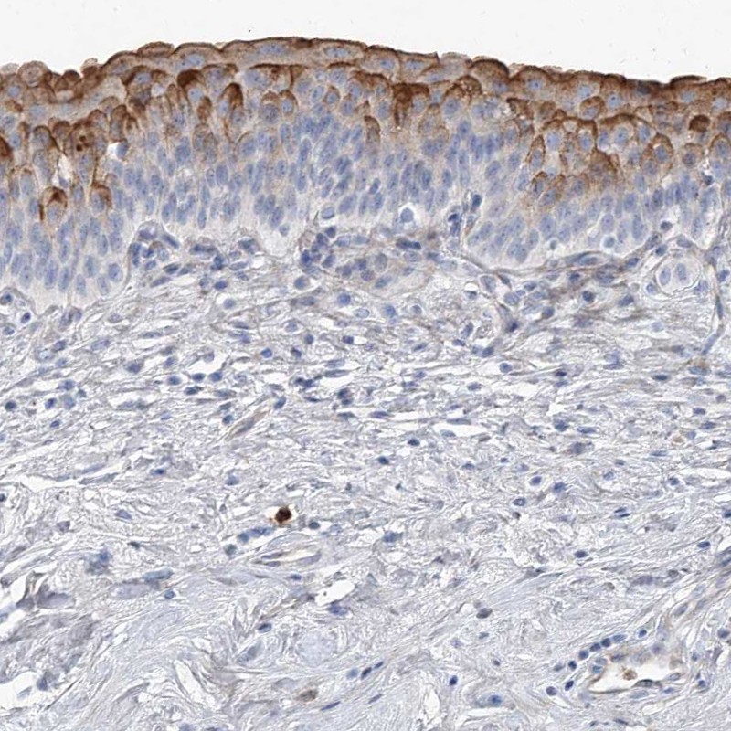 Anti-LIMK1 Antibody