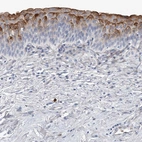 Anti-LIMK1 Antibody