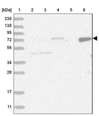 Lane 1: Marker [kDa] 230, 130, 95, 72, 56, 36, 28, 17, 11_br/_Lane 2: Human cell line RT-4_br/_Lane 3: Human cell line U-251MG sp_br/_Lane 4: Human plasma (IgG/HSA depleted)_br/_Lane 5: Human liver tissue_br/_Lane 6: Human tonsil tissue