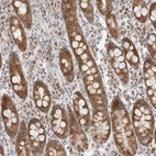 Immunohistochemical staining of human duodenum shows strong cytoplasmic positivity in glandular cells.