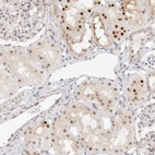 Anti-HIPK3 Antibody
