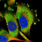 Immunofluorescent staining of human cell line U-251 MG shows localization to cytosol.