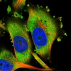 Immunofluorescent staining of human cell line U-251 MG shows localization to cytosol.